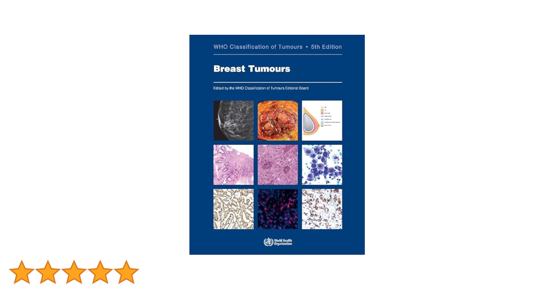 Breast Tumours (World Health Organization Classification of Tumours， 2) 71lJjXOWRYL._UF1000,1000_QL80_.jpg